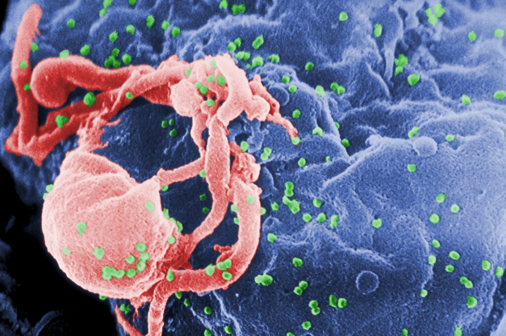 Hiv/aids: hiểu rõ về bệnh và cách phòng ngừa hiệu quả